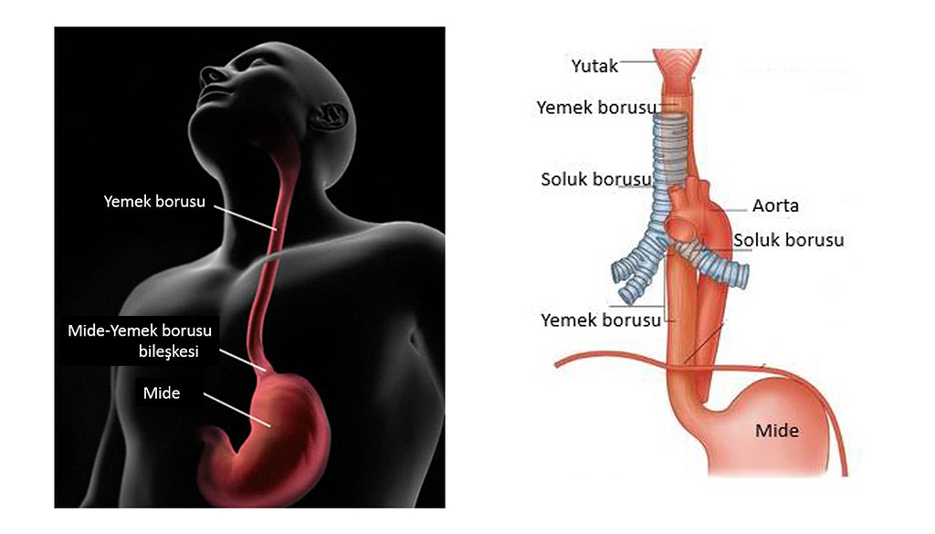  Gastroistestinal sistem kanserleri